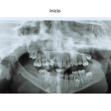 Ortodoncia Carlton pacientes con patologías especiales