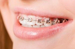[company_name_branding] ortodoncia en una persona