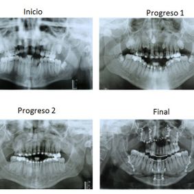 Ortodoncia Carlton patologías especiales 11