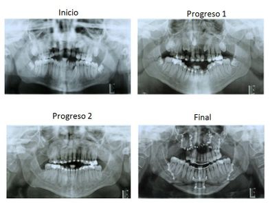 Ortodoncia Carlton patologías especiales 11
