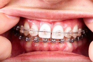 [company_name_branding] revisión de ortodoncia