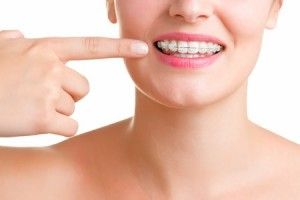[company_name_branding] persona señalando una ortodoncia