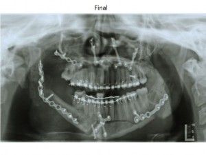 [company_name_branding] radiografía de la mandíbula 
