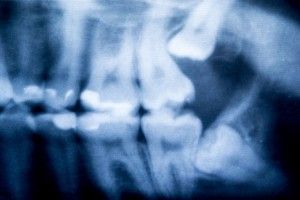 [company_name_branding] radiografía de unos dientes