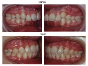 [company_name_branding] antes y después de un tratamiento dental