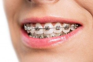[company_name_branding] tratamiento dental