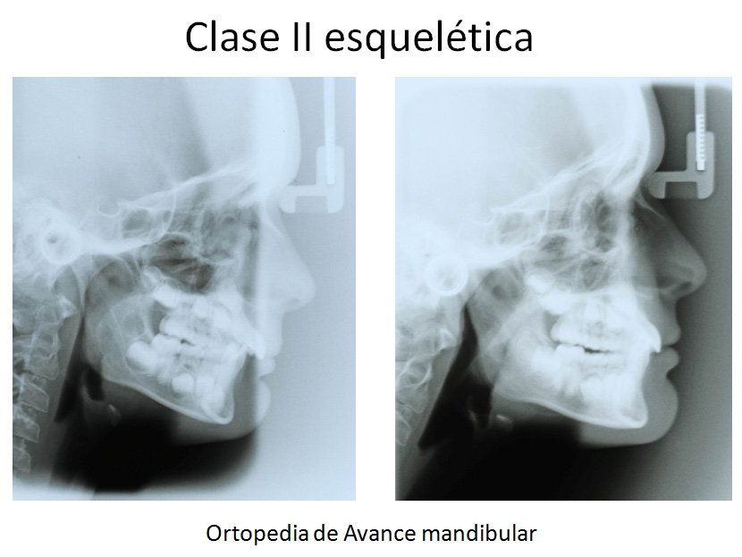 Ortodoncia Carlton ortopedia 