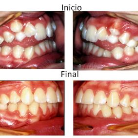 Ortodoncia Carlton tratamientos ontológicos 