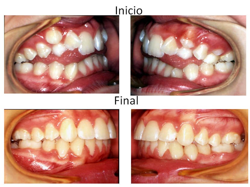 Ortodoncia Carlton tratamientos ontológicos 