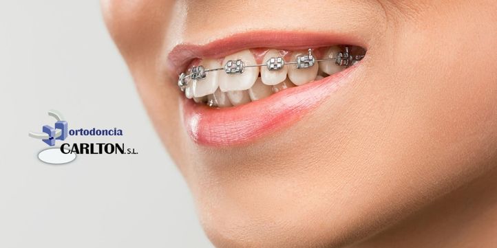 [company_name_branding] persona con ortodoncia