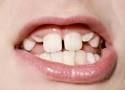 [company_name_branding] dientes de un niño