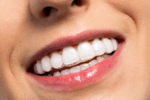  [company_name_branding] dientes blancos